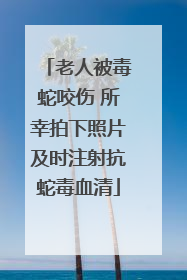 老人被毒蛇咬伤 所幸拍下照片及时注射抗蛇毒血清